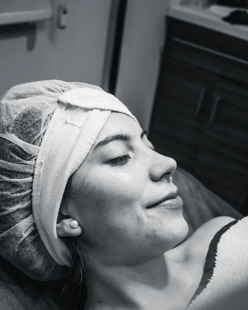 Peeling kwasami